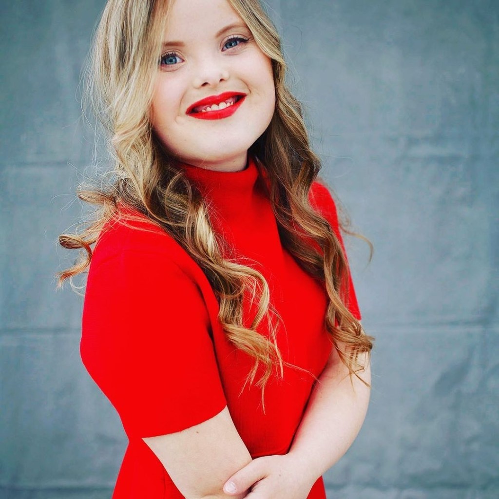 Modelo con Síndrome de Down logró su sueño de ingresar a una gran&nbsp;agencia