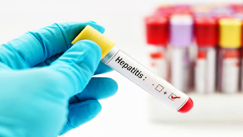OMS alerta sobre la nueva&nbsp;hepatitis