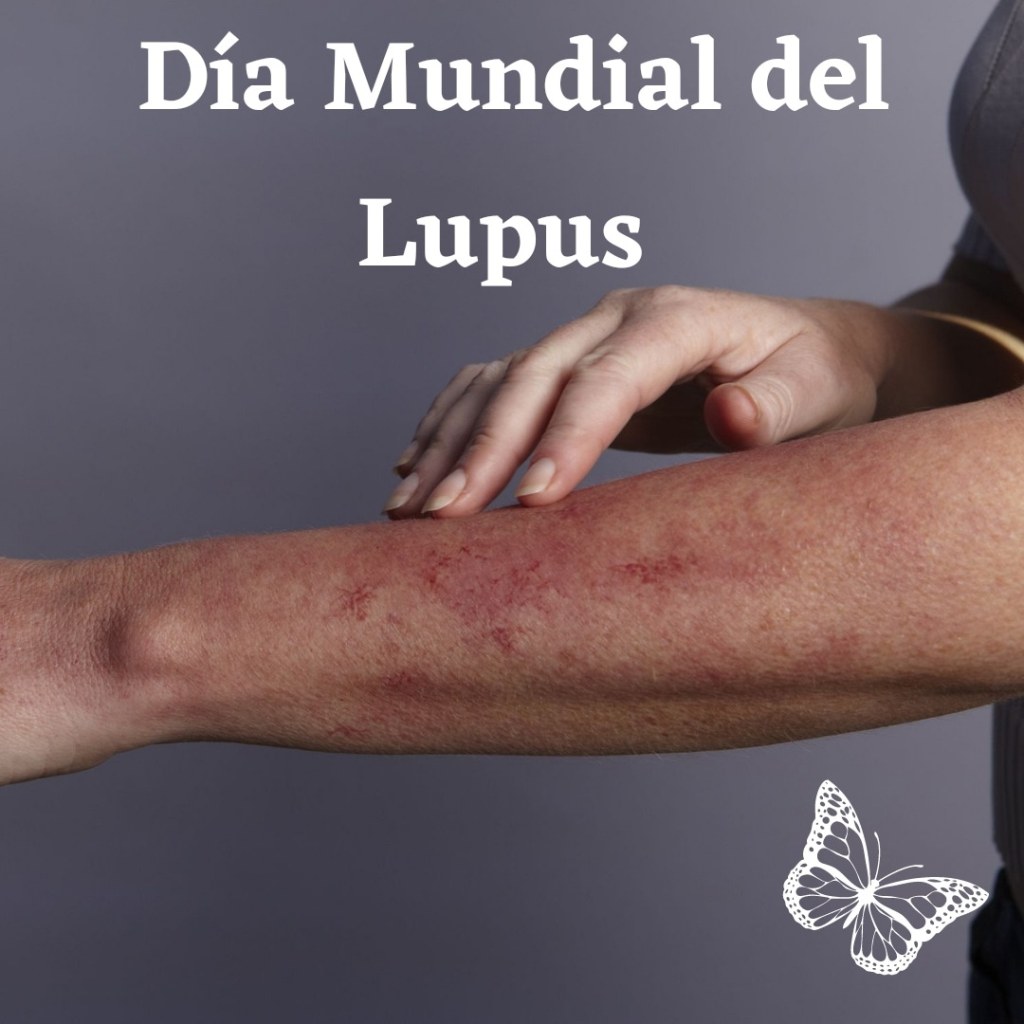 Día Mundial del&nbsp;Lupus