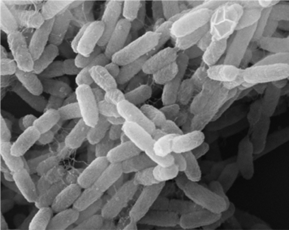 Yersinia Pestis ha causado más muertes humanas que cualquier otra enfermedad, sabes qué&nbsp;es?