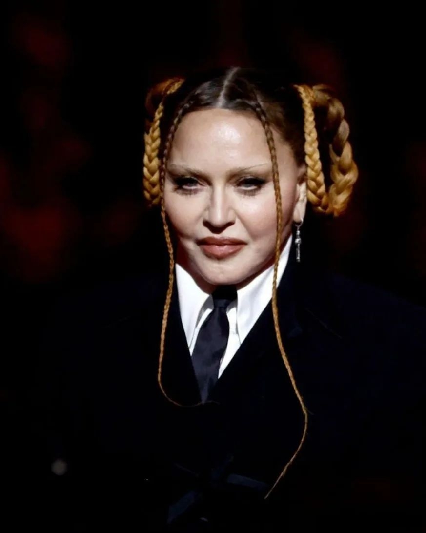 El criticado rostro de Madonna en los&nbsp;Grammys