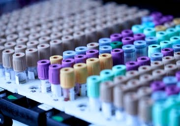 Adiós al tacto rectal para detectar el cáncer de&nbsp;próstata