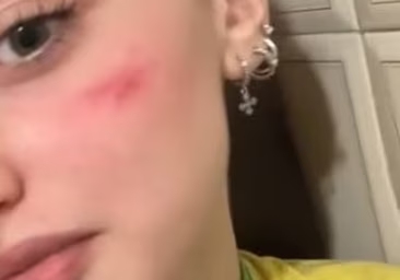 Nuevo reto vital de TikTok enciende alarmas en colegios&nbsp;italianos