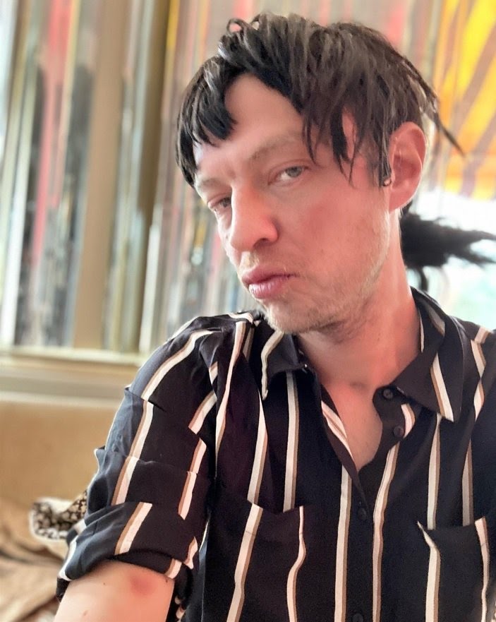 La imagen del hijo de Camilo Sesto que genera alarma en la farándula&nbsp;española