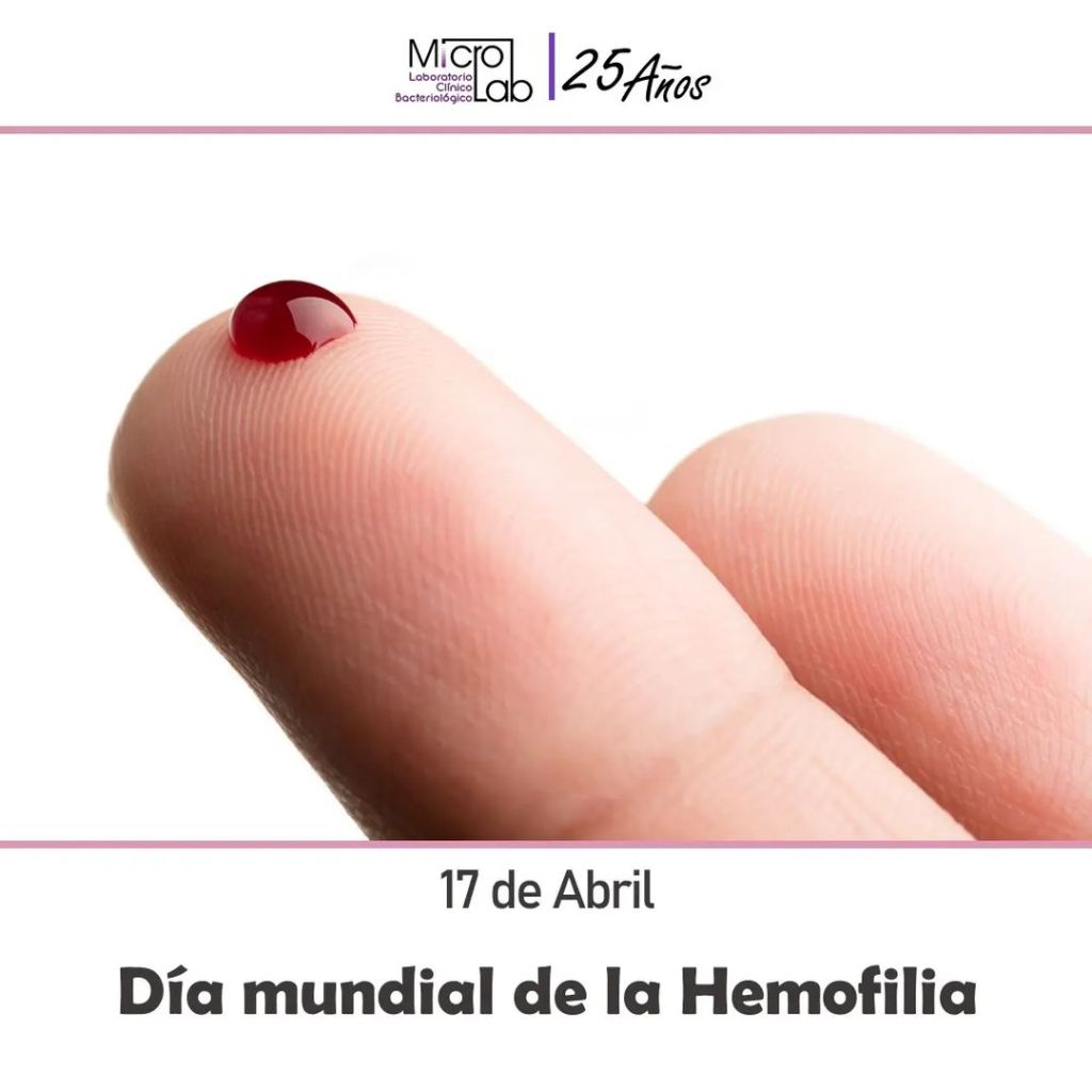 17 de abril día mundial la&nbsp;Hemofilia