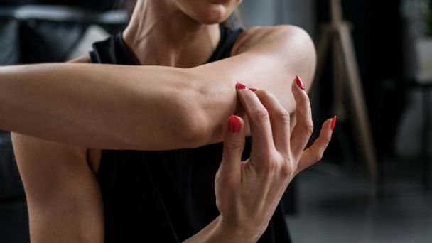 ¿Cómo adelgazar los brazos en un mes? Haz 1 ejercicio para eliminar ‘alas de murciélago’