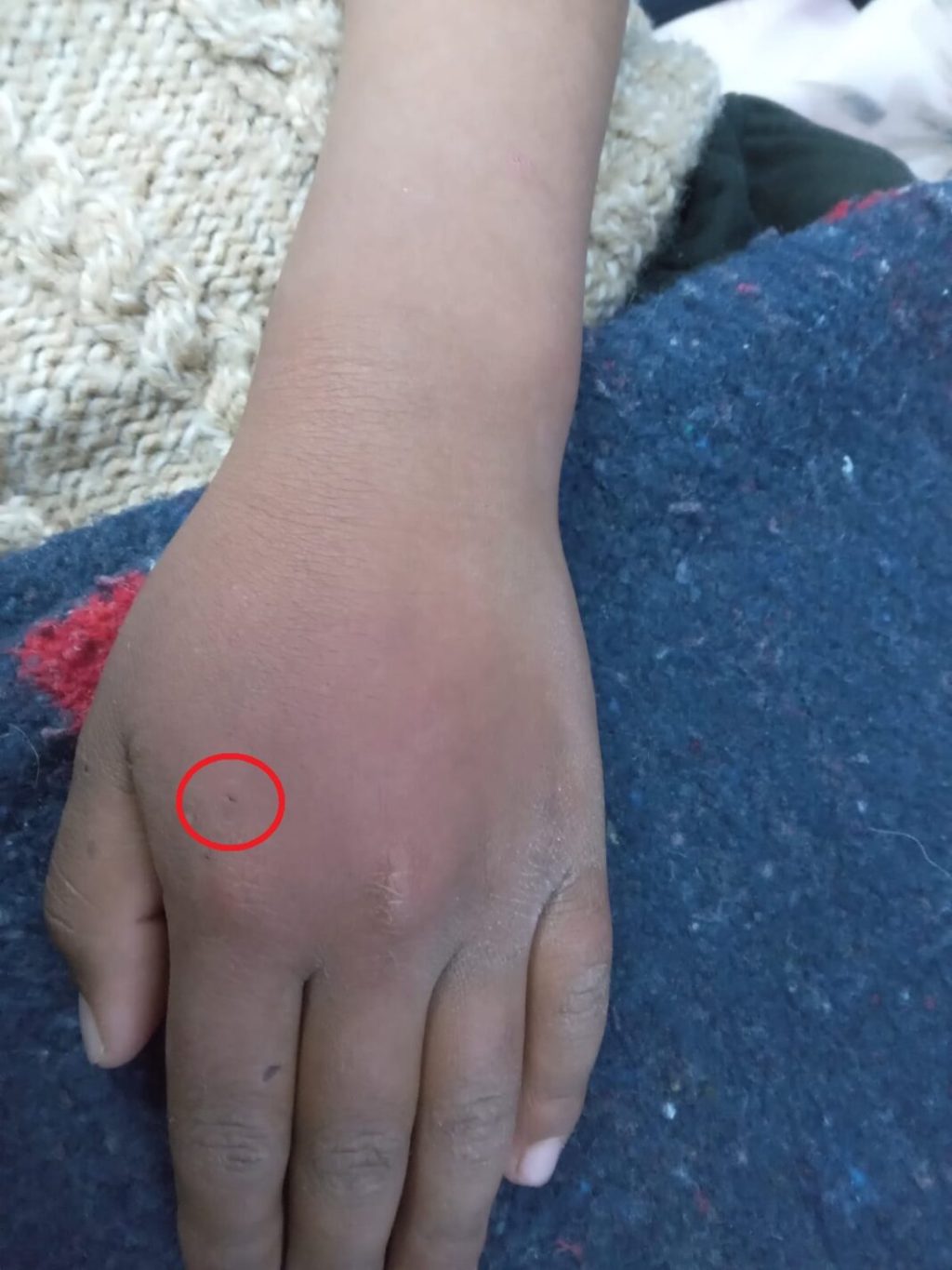 IMÁGENES | Niño se deja picar por una viuda negra para convertirse en&nbsp;Spider-Man