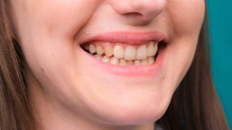 ¿Cómo usar la cúrcuma para “barrer” con los dientes amarillos en tres&nbsp;minutos?
