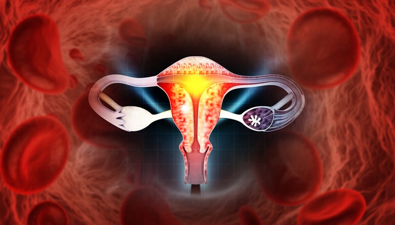 Nuevo análisis detecta el cáncer de ovario en fase&nbsp;temprana