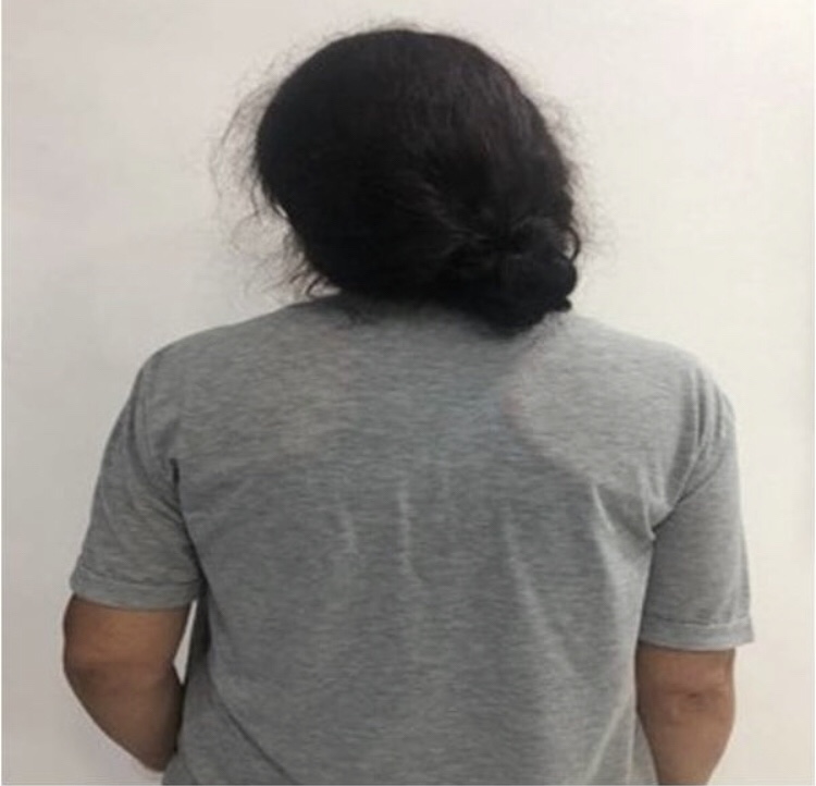 Detenida en Caracas por intentar asesinar a su hija Down cortándole las&nbsp;muñecas