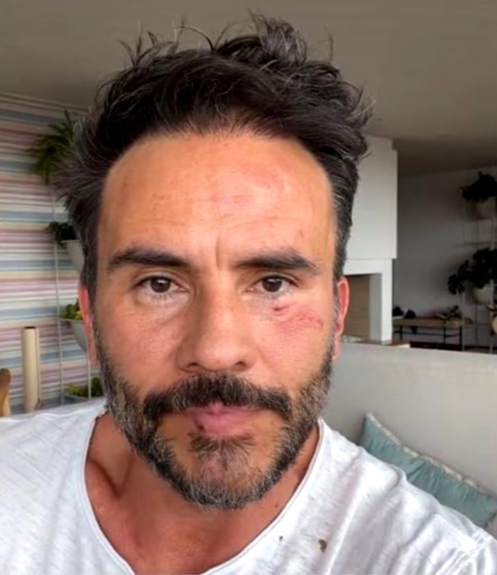 Asaltaron al actor Juan Pablo Raba. Delincuentes lo agredieron frente a sus hijos en&nbsp;Bogotá
