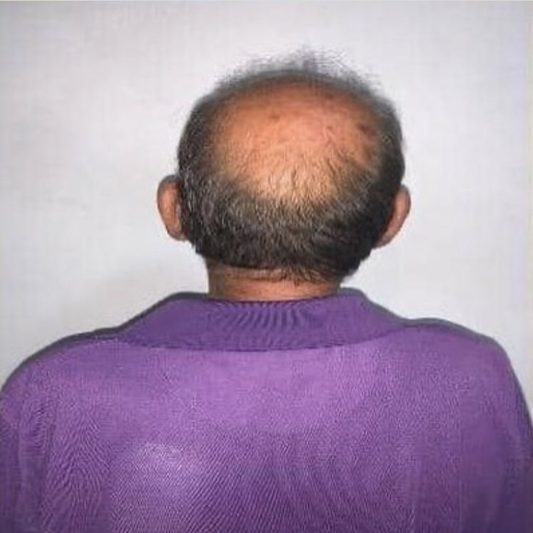 Liberado bajo régimen de presentación sexagenario acusado de envenenar a 12&nbsp;perros