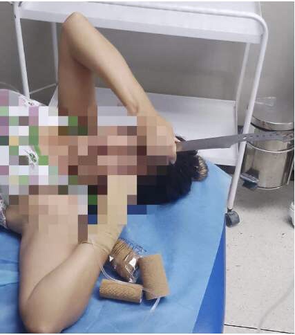 Una mujer en Aragua se peleó con su vecina y le clavó un cuchillo en la&nbsp;cabeza