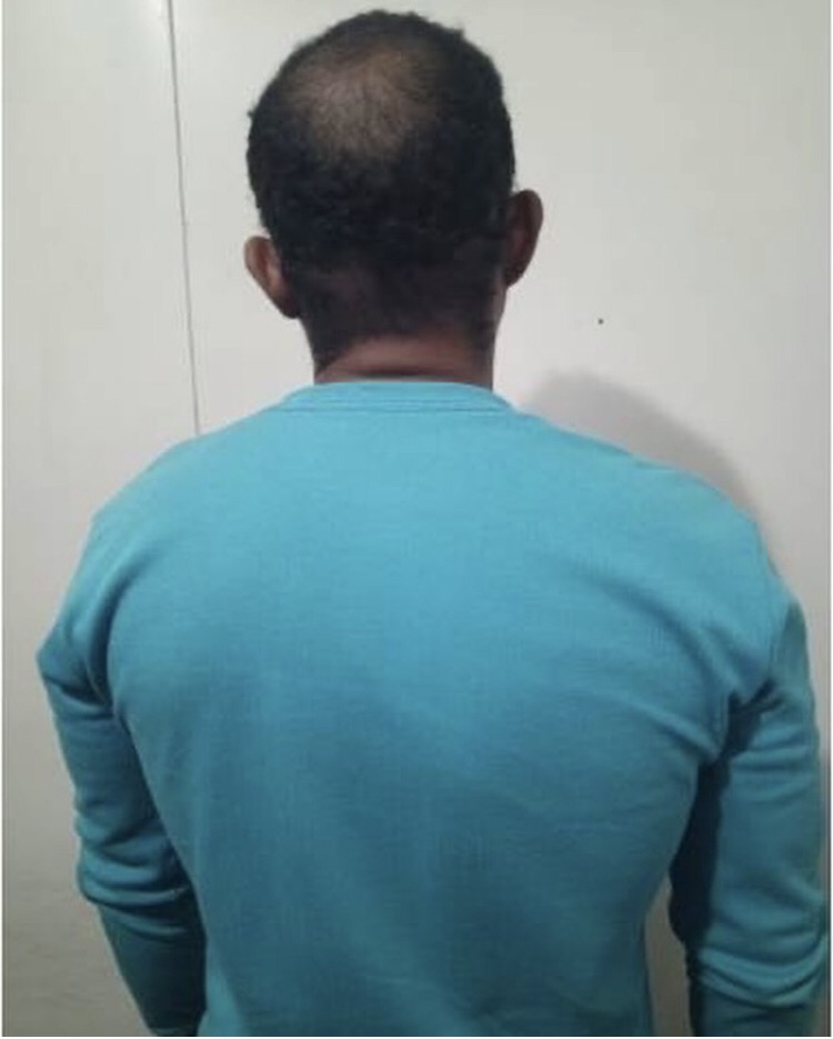 Un hombre fue detenido en Guanipa por usurpar funciones como odontólogo y&nbsp;ortodoncista