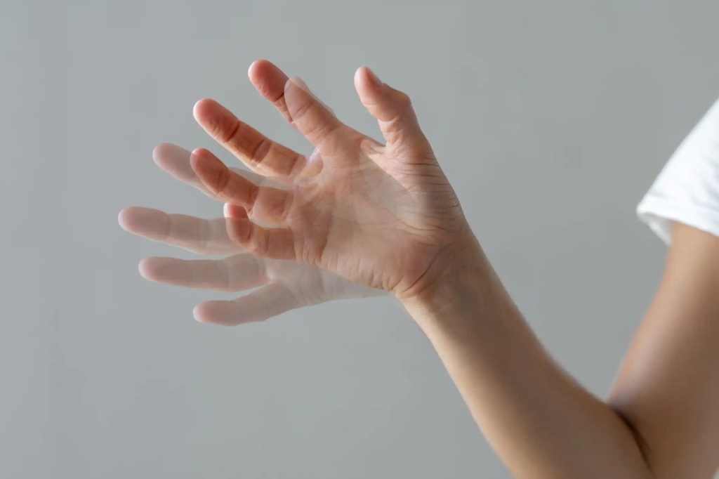 Nuevo anticuerpo podría reducir el deterioro motor de la enfermedad de&nbsp;Parkinson