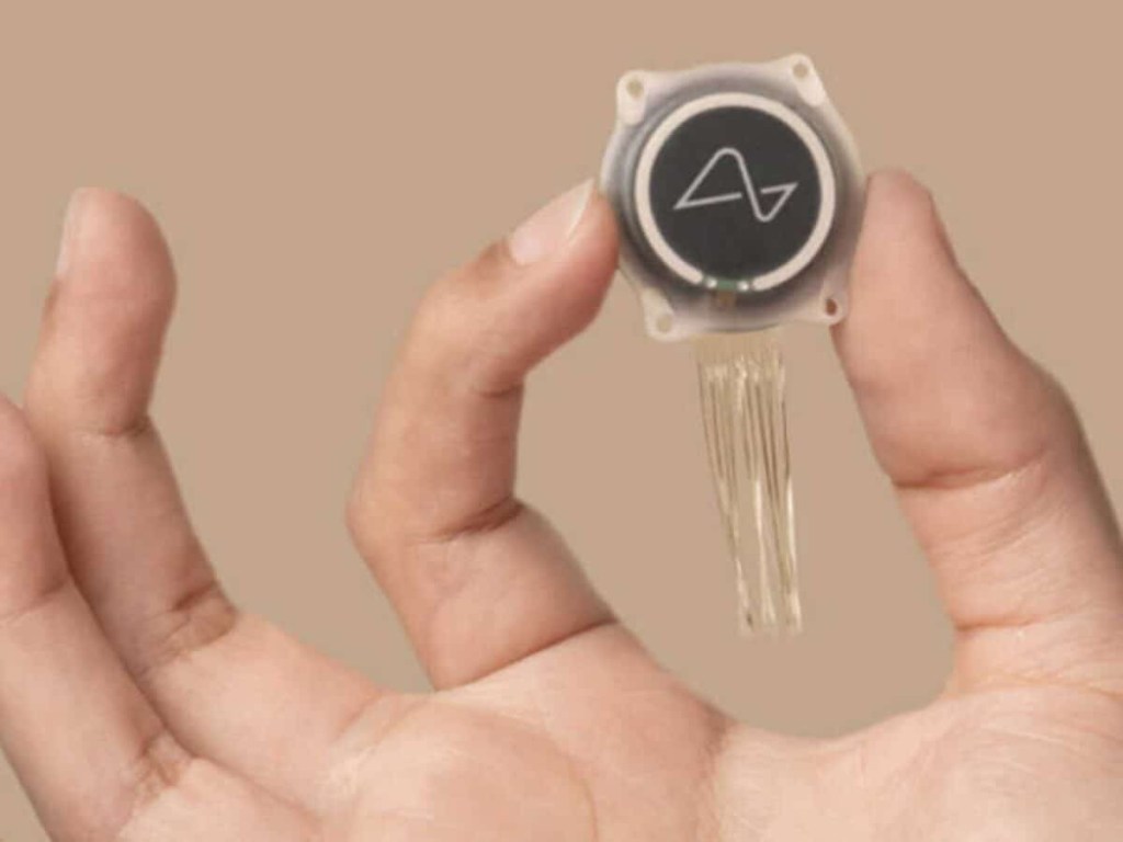 Neuralink revela que su primer implante cerebral en un humano presentó una&nbsp;falla