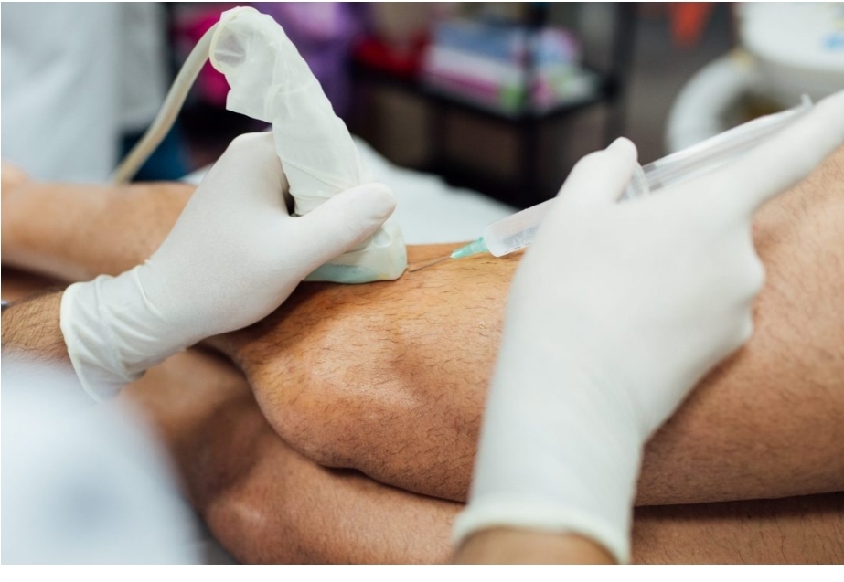 Regeneración de tejidos reduce cirugías y reposos por artritis y otros padecimientos&nbsp;articulares