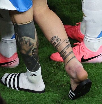Así le quedó el tobillo a Messi tras sufrir&nbsp;lesión