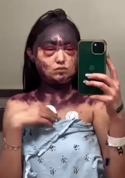 Joven casi perdió la vida tras recibir tres&nbsp;vacunas