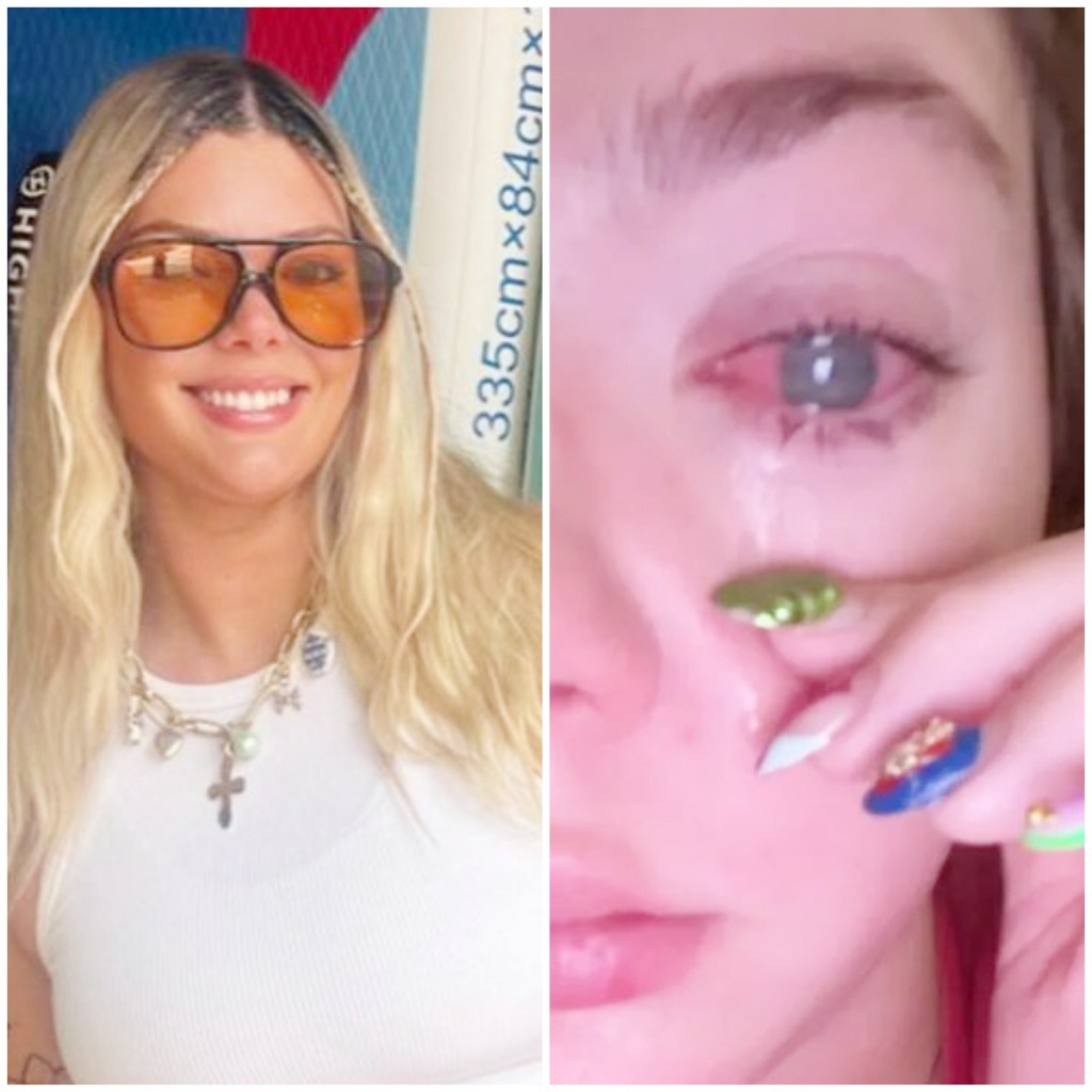 Joven pierde la visión de un ojo por nadar con lentes de contacto en la&nbsp;playa&nbsp;