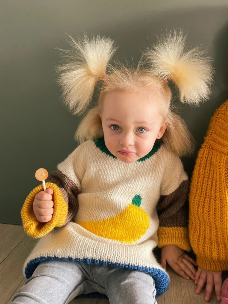 Coco, la niña con el síndrome del pelo&nbsp;indomable