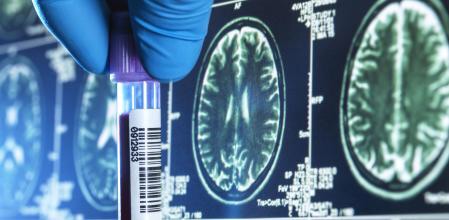 Descubren una proteína que podría frenar el envejecimiento&nbsp;cerebral