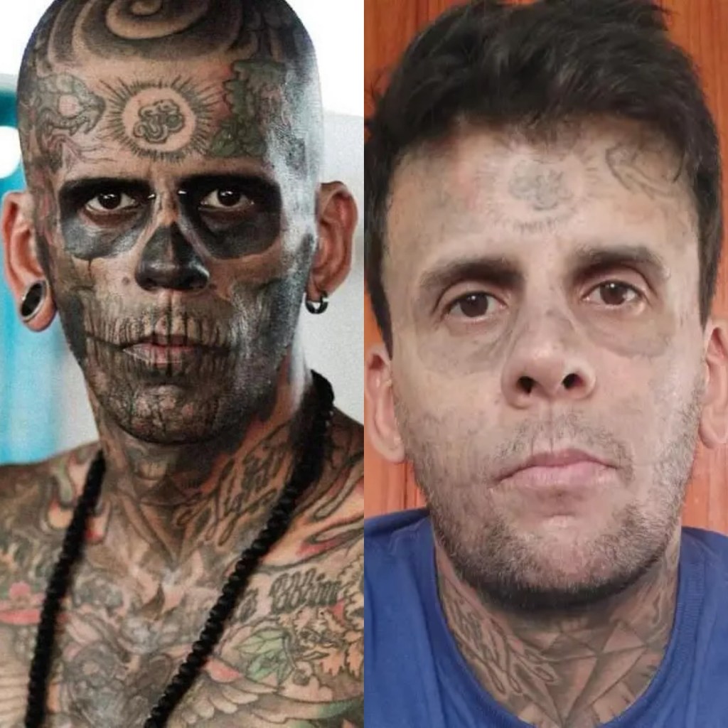 El «Hombre Más Tatuado» de Brasil se borra sus tatuajes en búsqueda de una nueva&nbsp;identidad