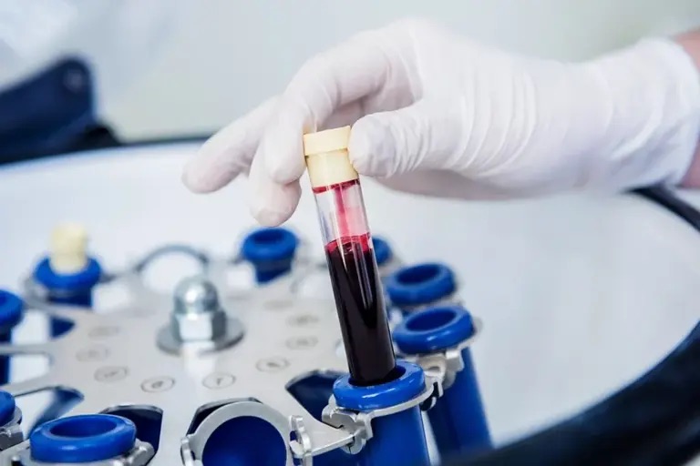 Innovador avance: Científicos desarrollan sangre artificial&nbsp;universal