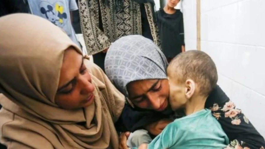 Hambruna en Gaza: Asciende a 88 el número de niños fallecidos por&nbsp;inanición