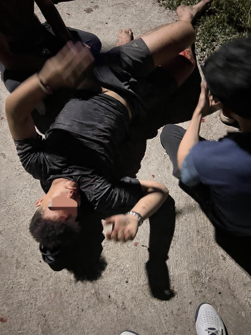 Conductor de camioneta Merú se da a la fuga tras arrollar a motorizado en la Vía&nbsp;Rincón