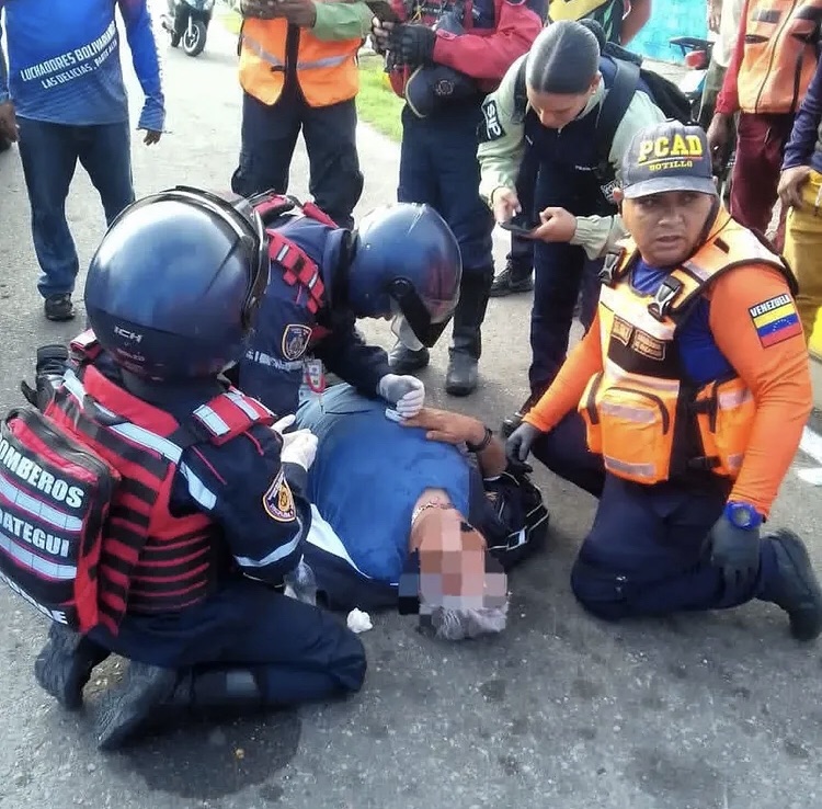 Motorizado de 59 años resultó lesionado tras derrapar en Puerto La&nbsp;Cruz&nbsp;