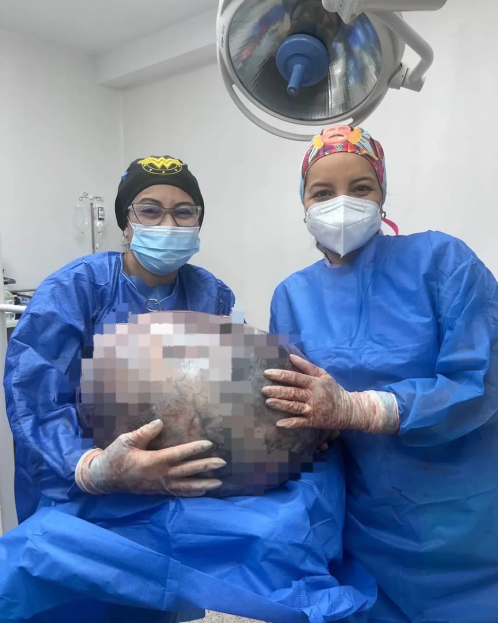 Equipo médico del Razetti extrajo tumor de 25 kilos a mujer de 52 años del municipio&nbsp;Sotillo