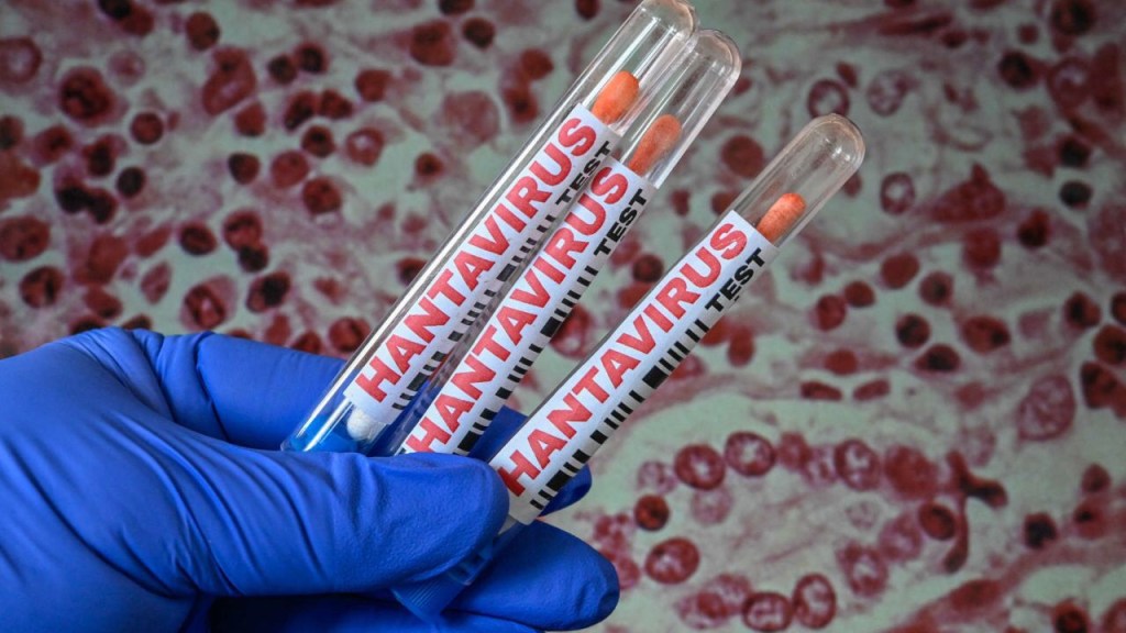 Ministerio de salud confirmó muertes por casos de “Hantavirus”
